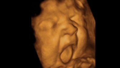 Ultrasonido de embarazo 38 semanas # 4