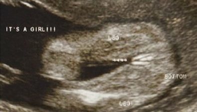 Ultrasonido de embarazo 35 semanas # 4