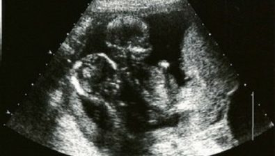 Ecografía de embarazo de 19 semanas # 4