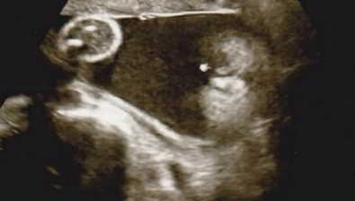 Ultrasonido de embarazo de 30 semanas # 4