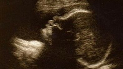 Ultrasonido de embarazo de 30 semanas # 2